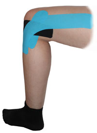 Outer Knee Taping