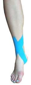 Ankle Sprain Taping