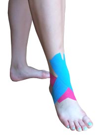 Ankle Sprain Taping