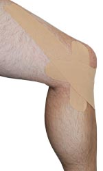 Inner Knee Strain Taping