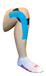 Outer Knee Taping